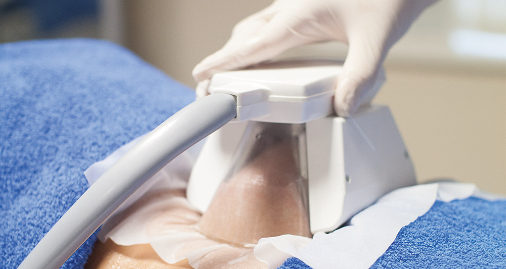 How Fat Freezing and HIFU Work Together? 2 Multiple Areas in One Session HIFU and Fat Freezing Dudley