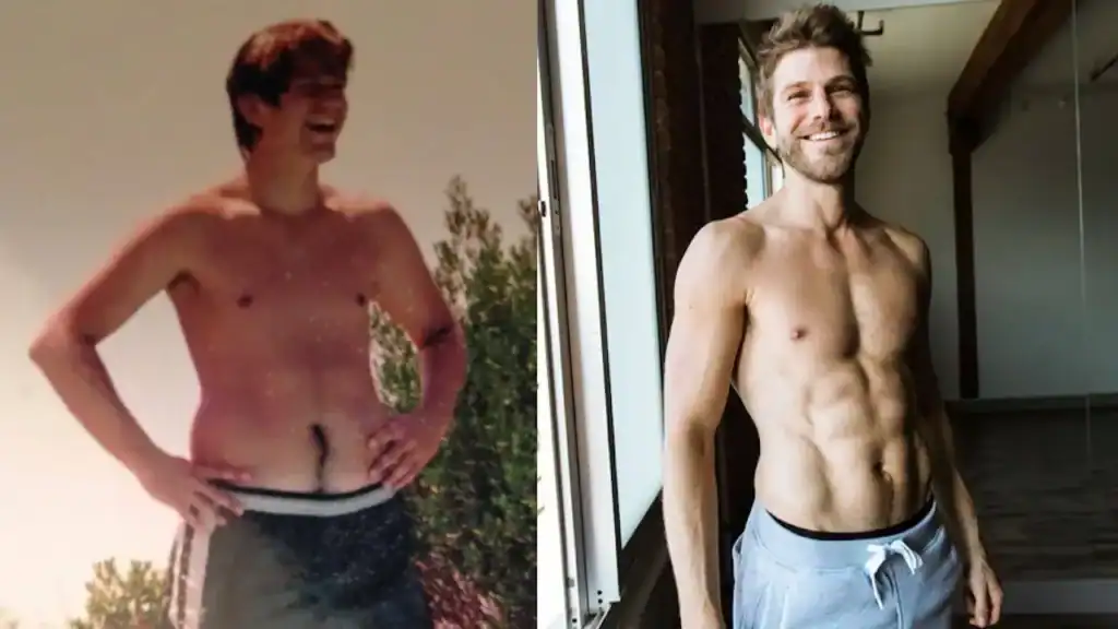 Lipo 360 Dudley fat loss where does it go?